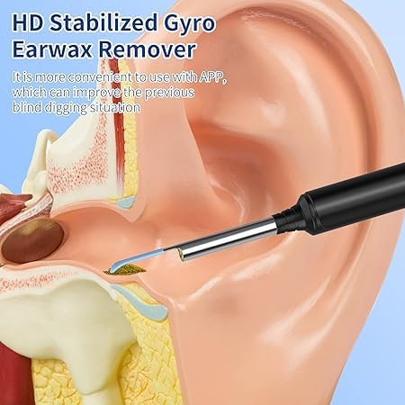 Ear Endoscope Wax Cleaner